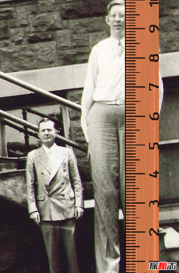 世界上最大的人:罗伯特・潘兴・瓦德罗(高达2米72)